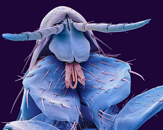The head of a human flea